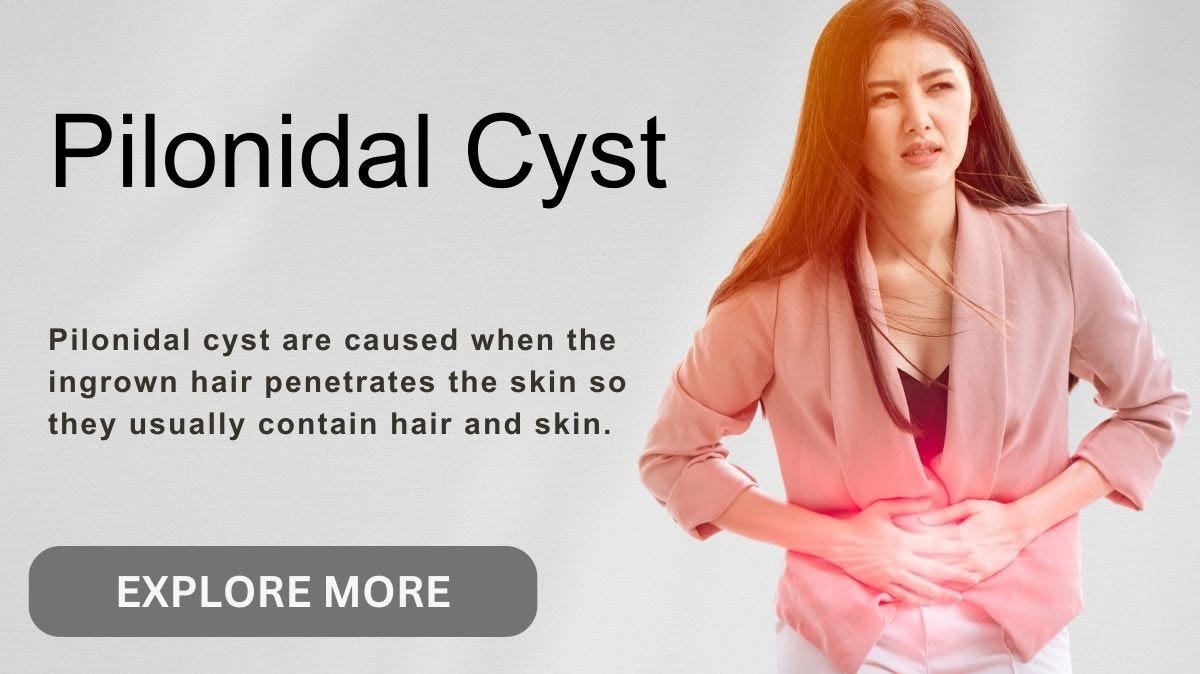 Find the Most Effective Treatment for Pilonidal Cyst DaniellaLloyd