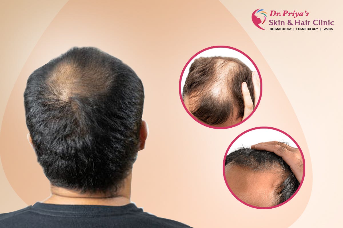 What doctor to see 2025 for male hair loss