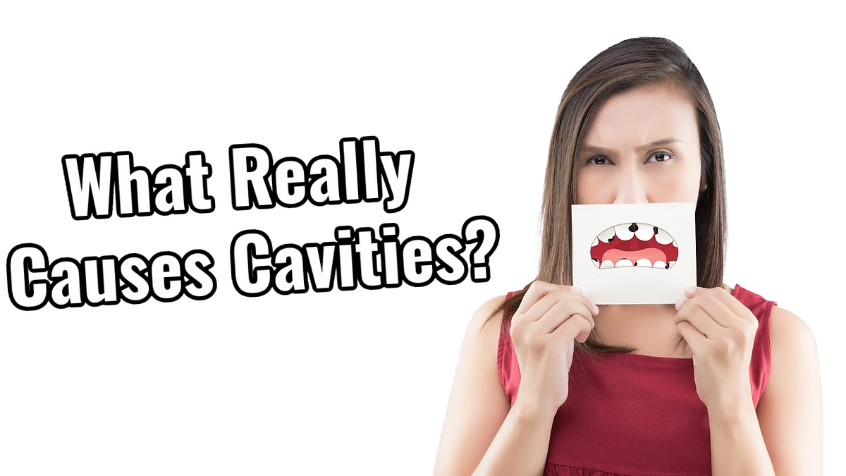 What Really Causes Cavities? | How Long Does it Take For a Cavity to ...