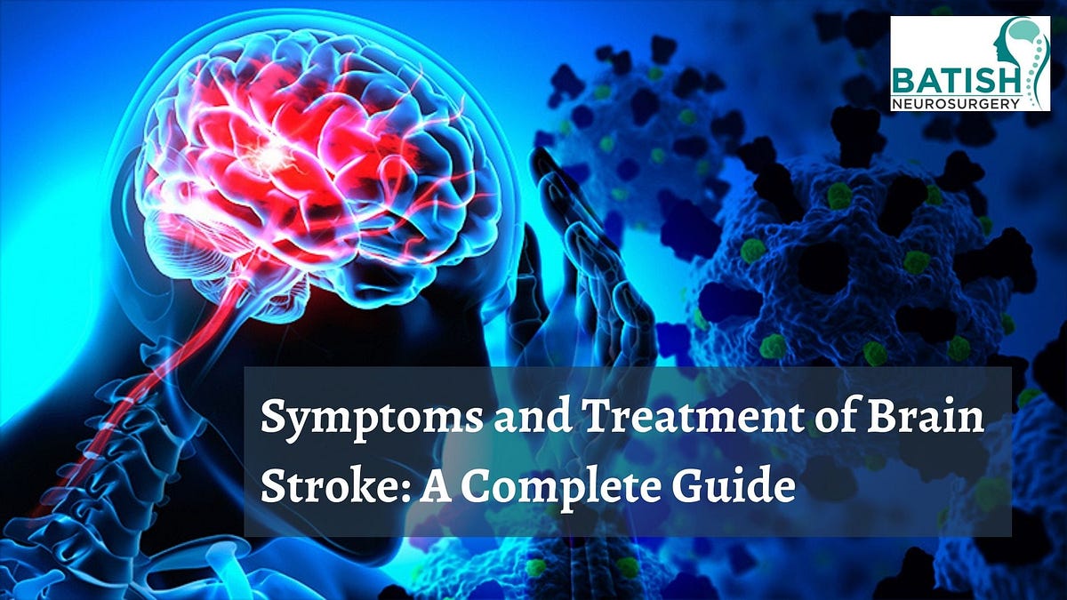 Symptoms And Treatment Of Brain Stroke: A Complete Guide 