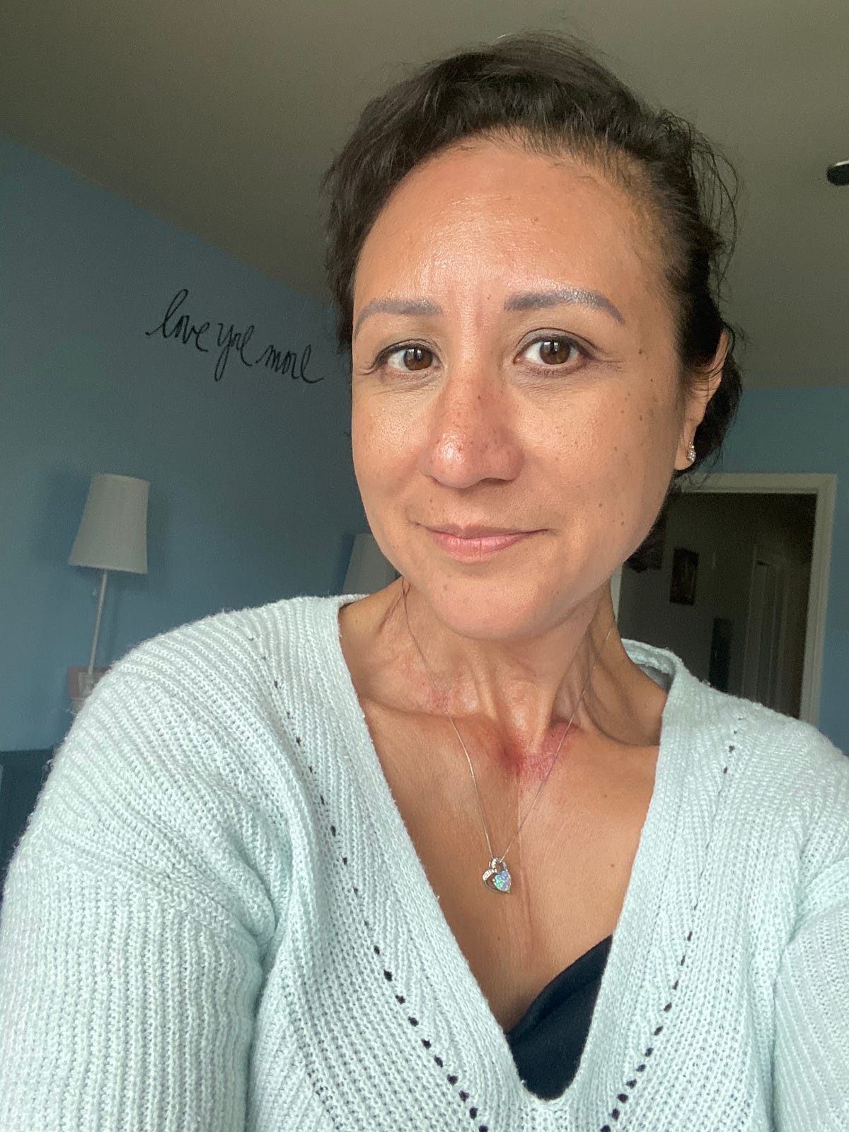 Four things no one tells you about post chemo life by michelle c. s