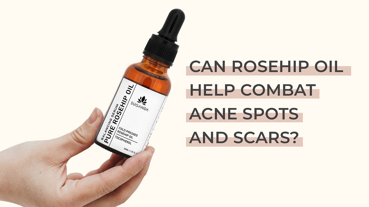 CAN ROSEHIP OIL HELP COMBAT ACNE SPOTS AND SCARS? | by suganda | Medium