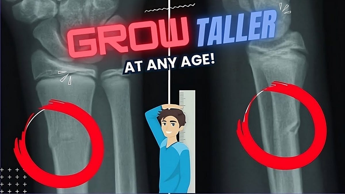 You Growth Plates NEVER Really Close! GROW TALLER AT ANY AGE — HOW TO by Grow Taller For