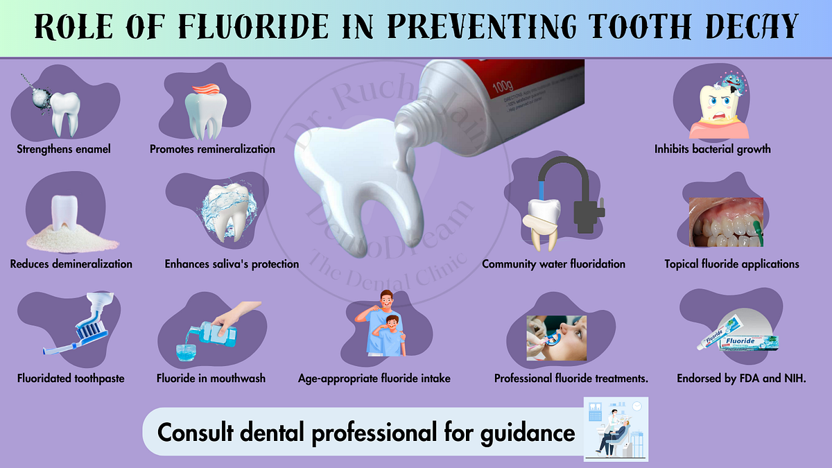 The Role of Fluoride in Preventing Tooth Decay by Dr Rucha Jain