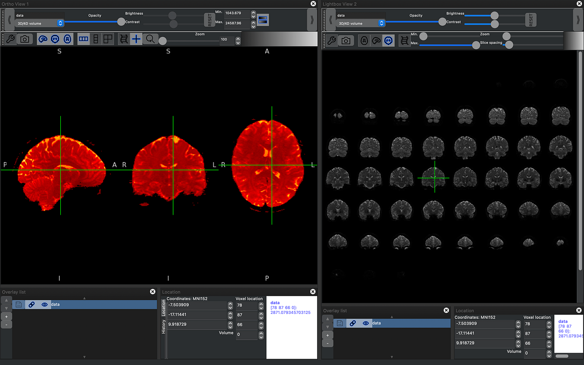 Processing MRI Images on Raspberry Pi! | by Dev Chhatbar | Mar, 2024 ...