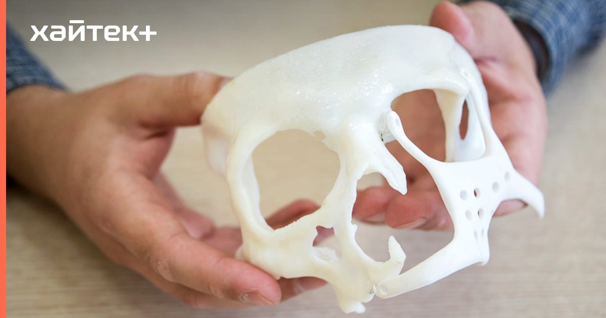 3d-печать костных имплантов. протез кости. протез на 3д принтере титан. эндопротез тазобедренного и коленного сустава. протез кости.