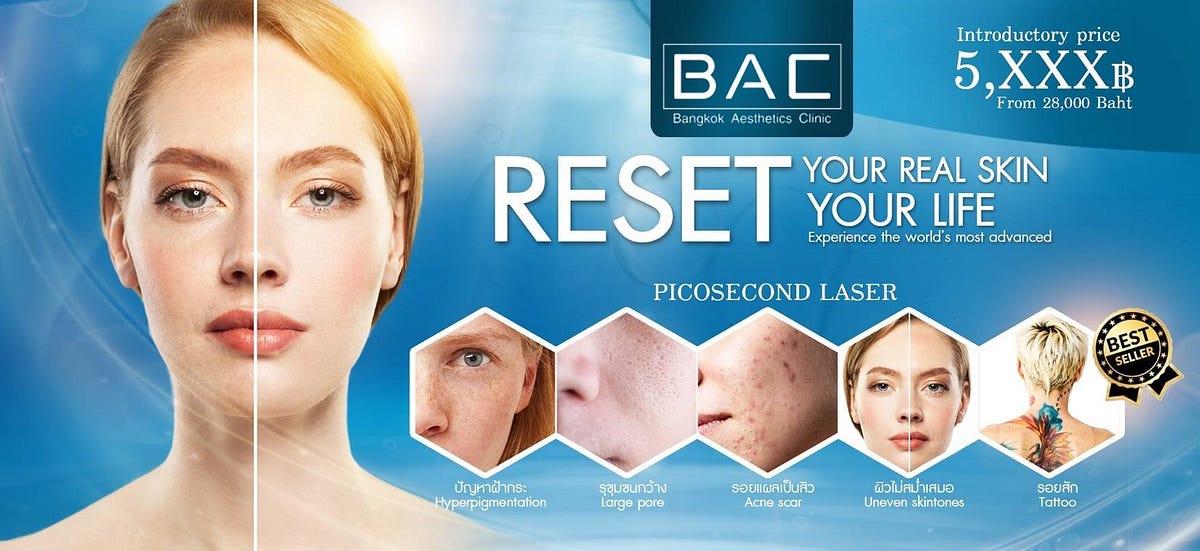 PicoSecond Laser in Bangkok, Thailand Erase tattoo,Acne Scars and