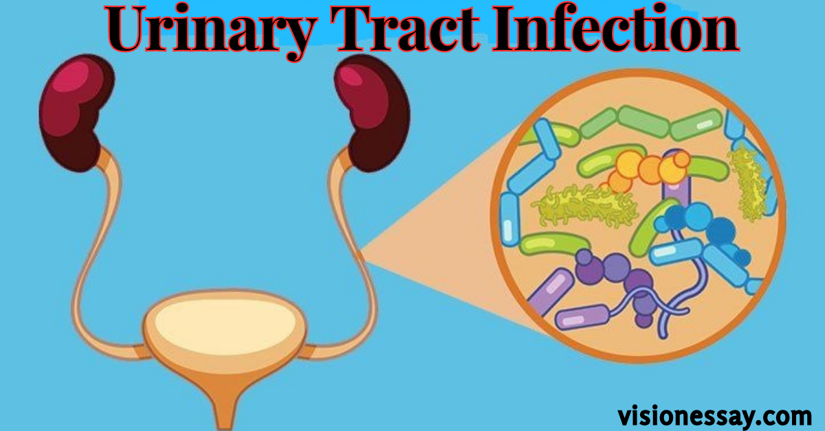 Urinary Tract Infection(UTIs), Symptoms And Cause 2023 | By Andrew | Medium