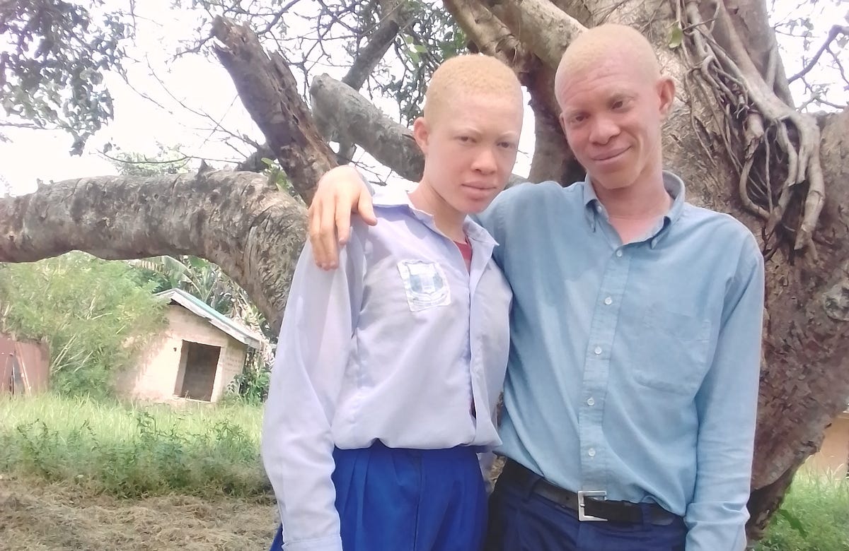 I gotta say, albine mutation looks sick!