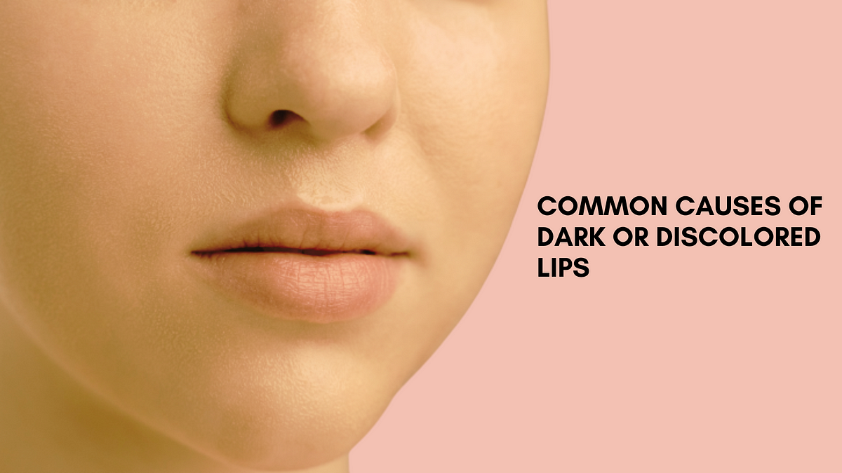 What are the common causes of dark or discolored lips, and how can they ...