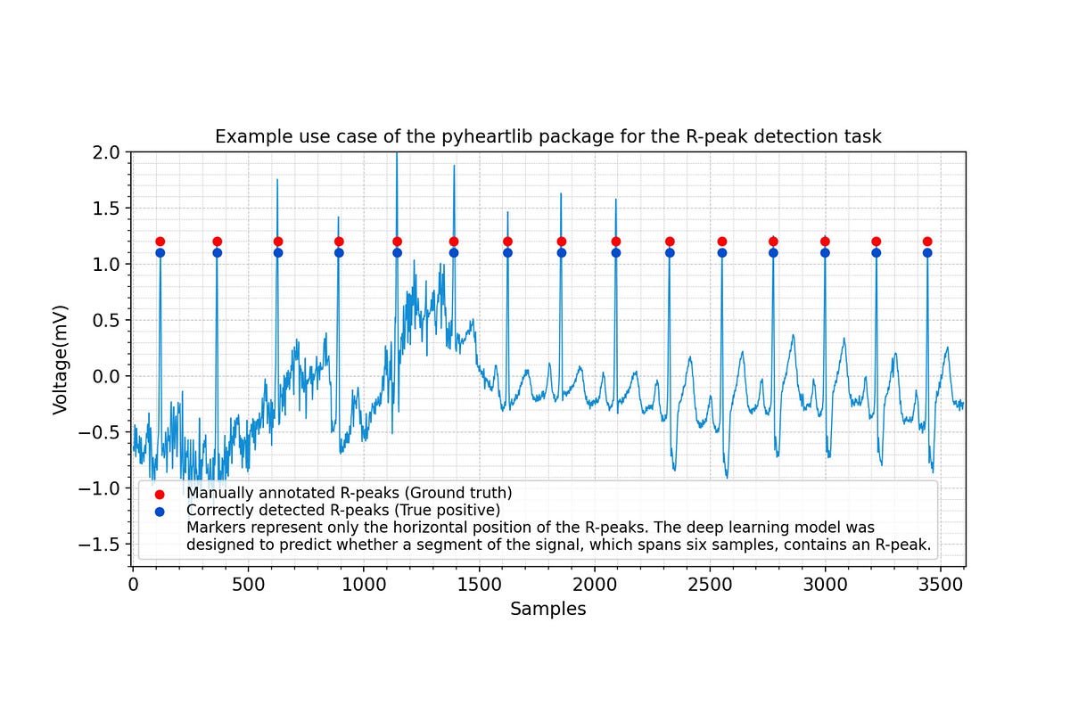 Pyheartlib is a Python package for processing electrocardiogram (ECG) recordings. This software