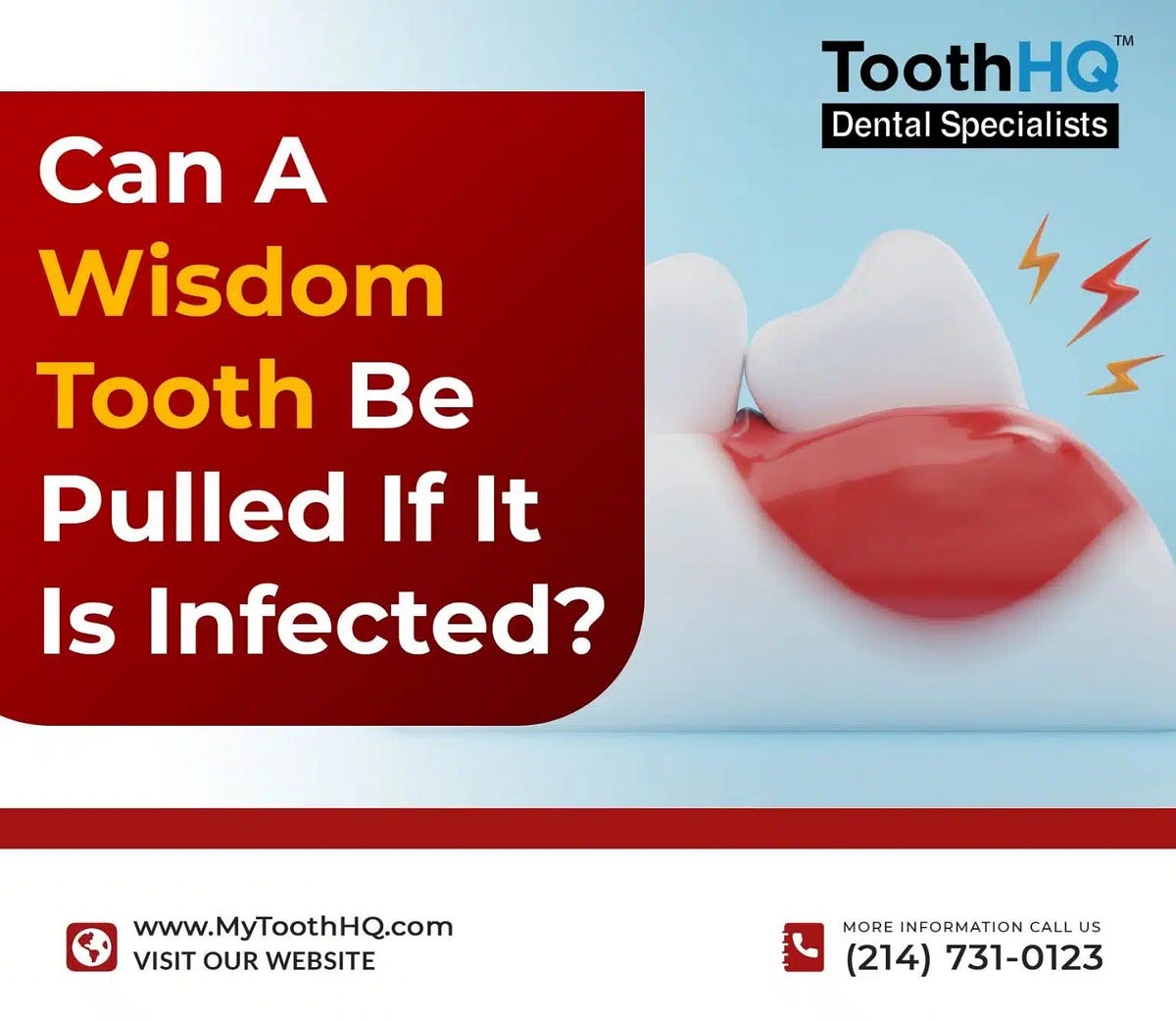 Can A Wisdom Tooth Be Pulled If It Is Infected? by mytoothhq Jun