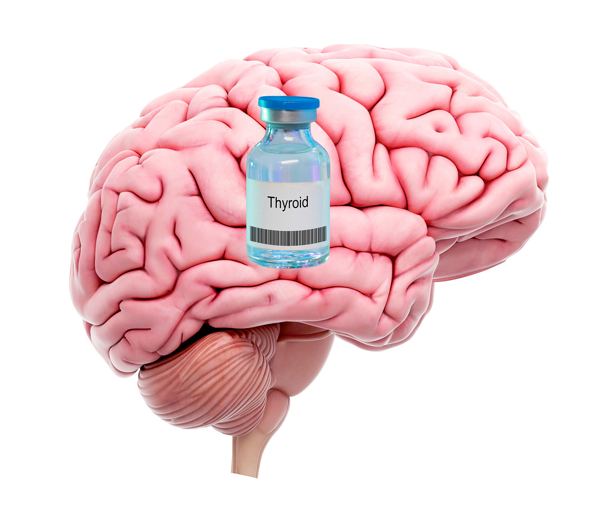 Excessive Thyroid Medication Linked to Cognitive Disorders by Annie
