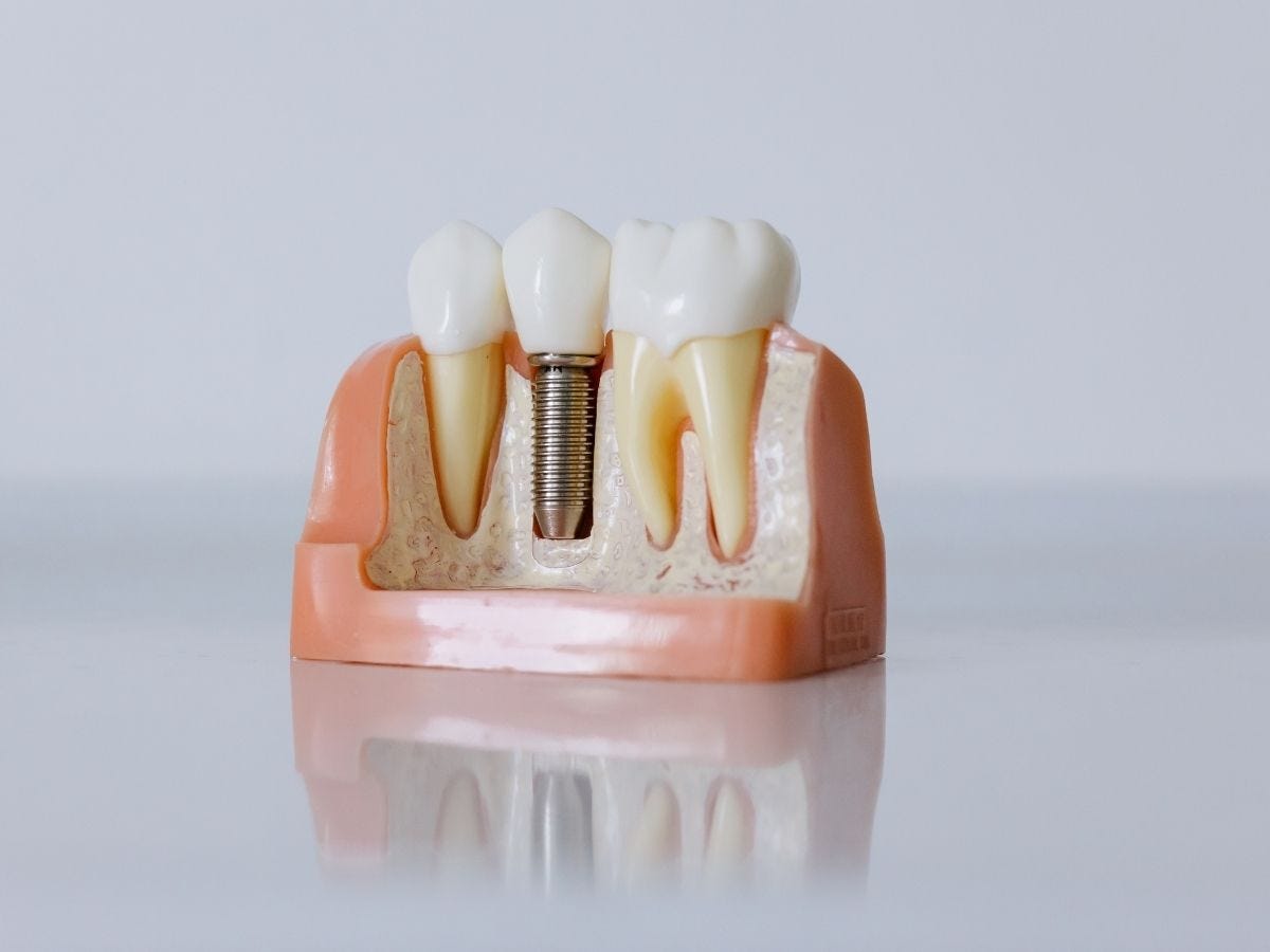 Modern Dentistry in Simi Valley Has Changed the Patient Experience
