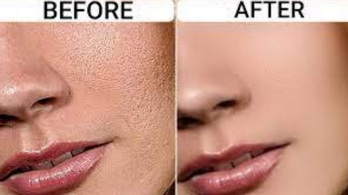 How To Improve Rough Skin Texture — A Guide For Getting Smooth Skin By Roheena Chudhary Medium 0243