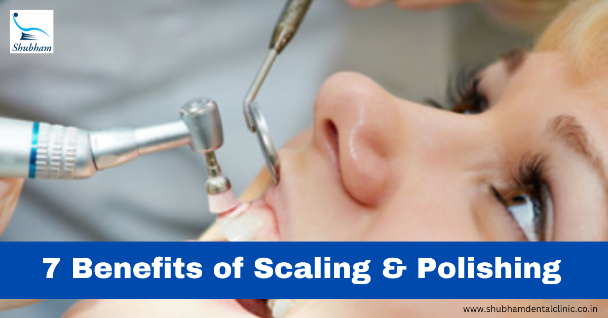 7 Benefits of scaling and polishing Dr. Rinku Mittal Medium