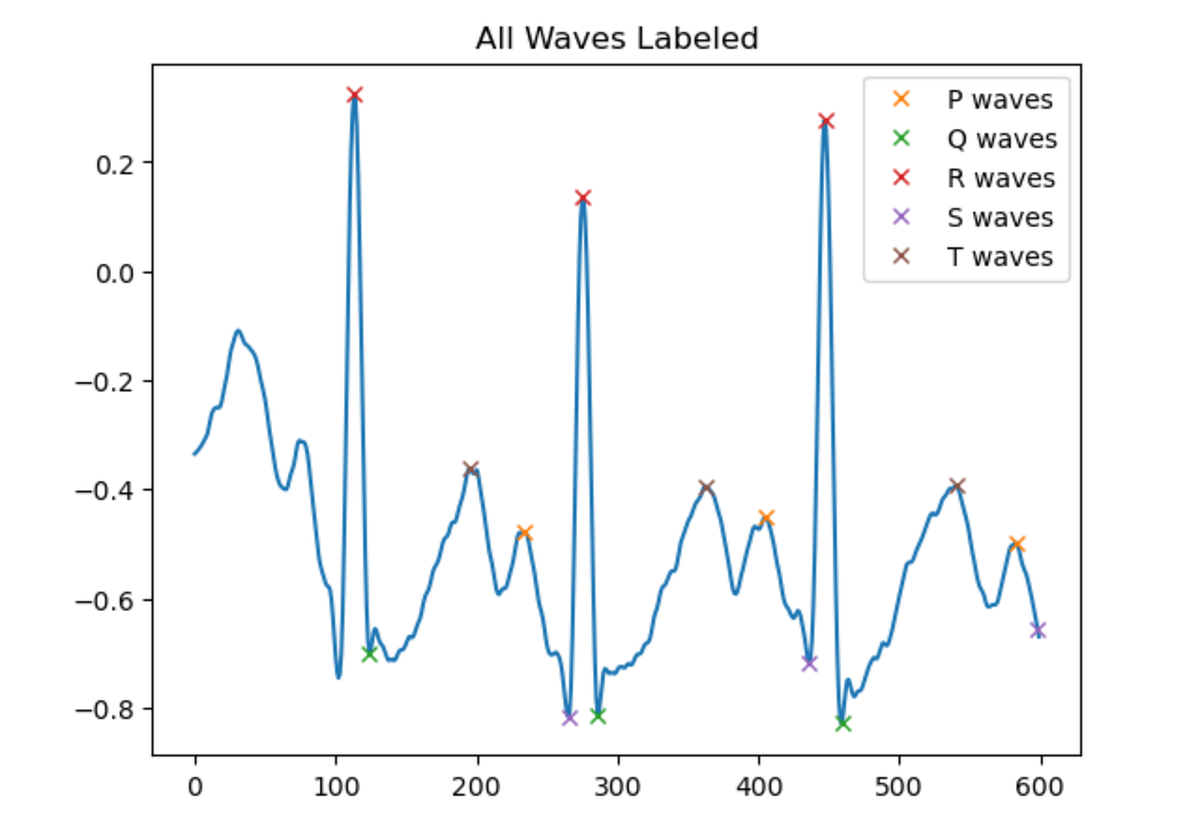 Heart Analysis with Python (Part 2: Labeling EKGs with Code) | by Proto ...