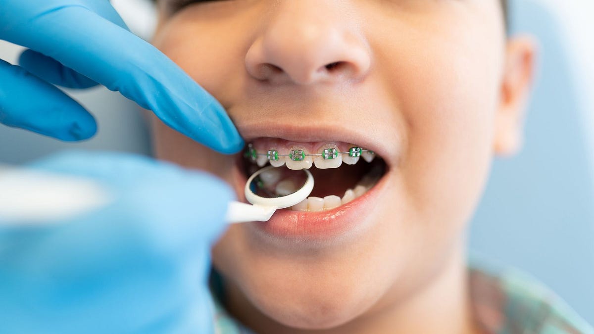Unlocking Smiles Choosing the Best Kids Orthodontist in Albuquerque