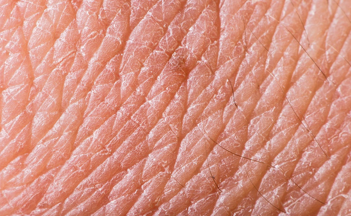 The Itch Nobody Can Scratch. A new disease is plaguing thousands… by