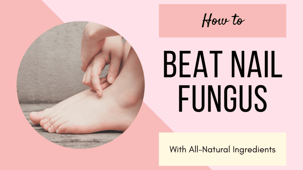 Get Rid Of Nail Fungus Forever — 2 Ingredient Recipe Coriejcanchola