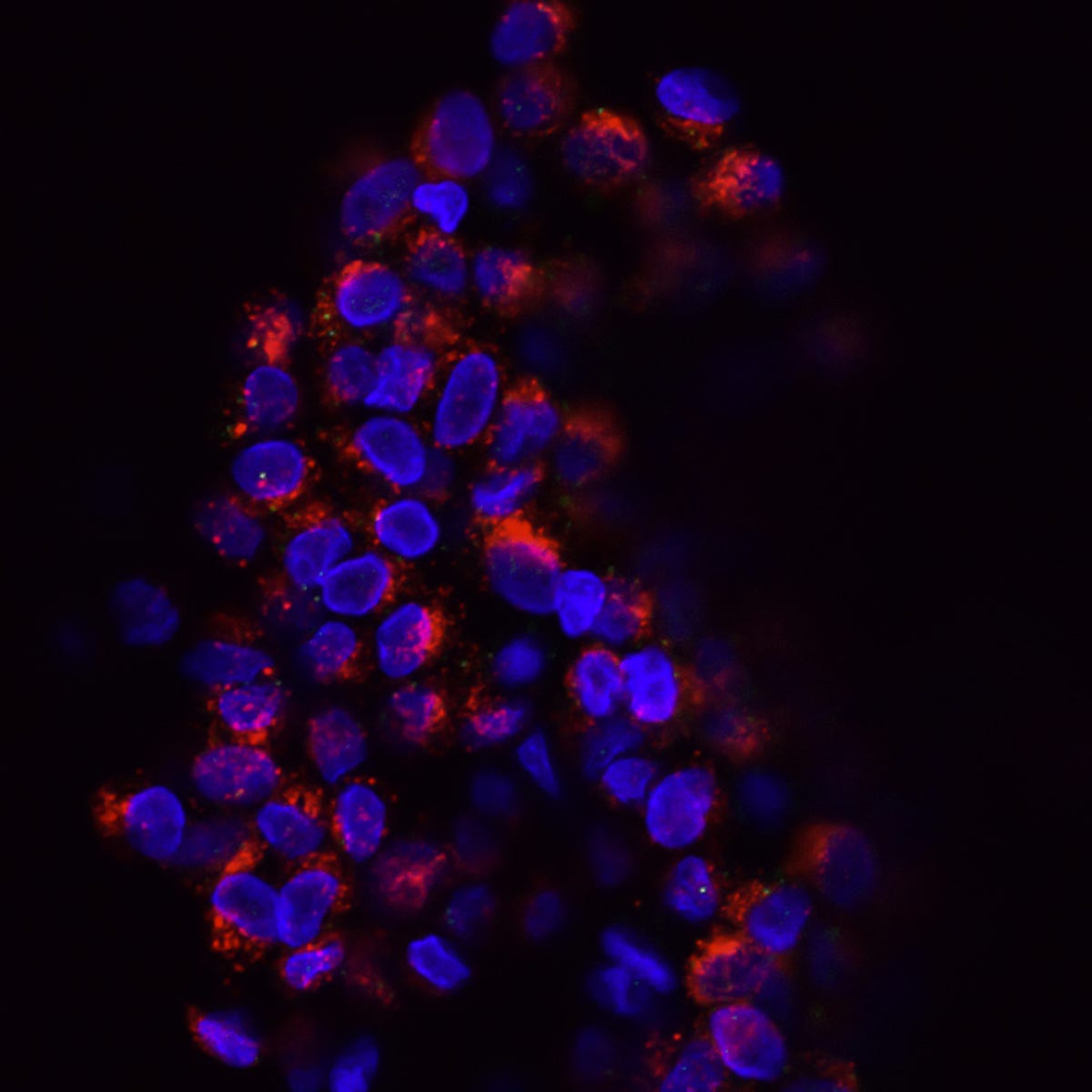 Save your Breasts. and, yes men need to save too! by Dr. Ruchika