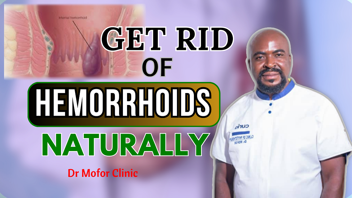 Hemorrhoid Piles How To Get Rid Of Hemorrhoids Effective