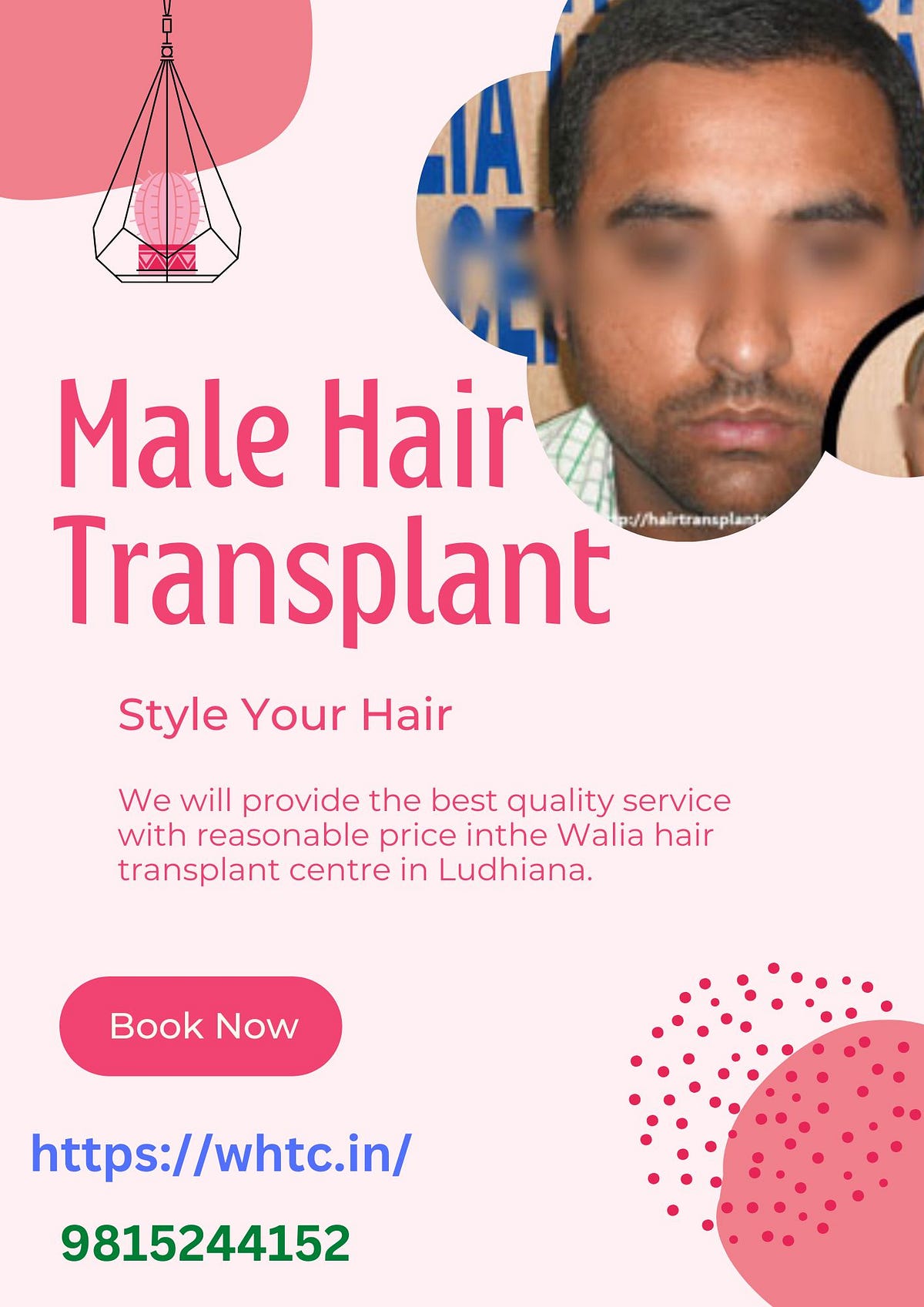 Hair transplant in Ludhiana? Services 1. Fue hair transplantation 2