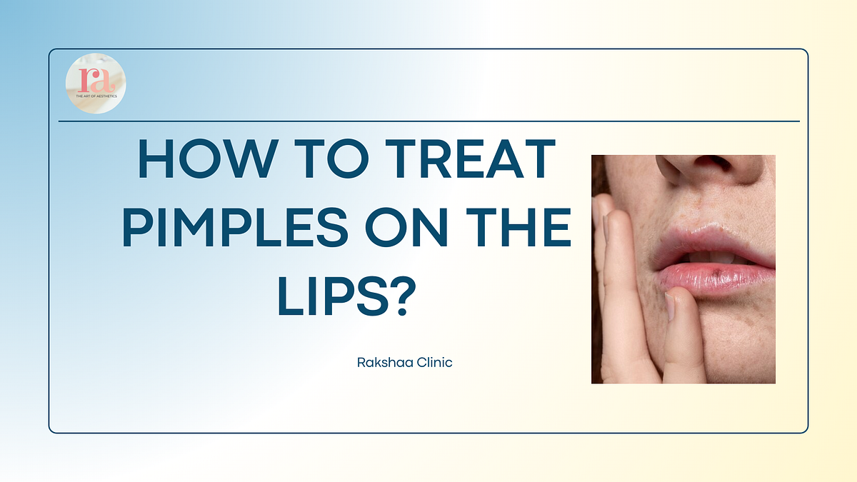 How to Treat Pimples on the Lips? Rakshaa_clinic Medium