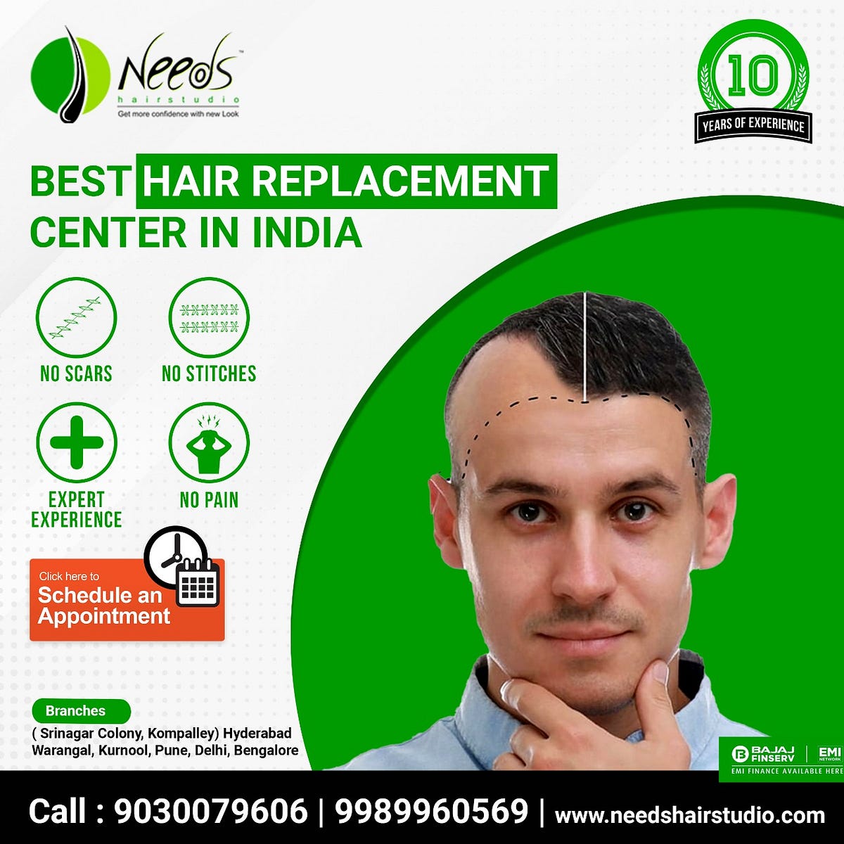 hair replacement service in hyderabad Reyanshhari Medium