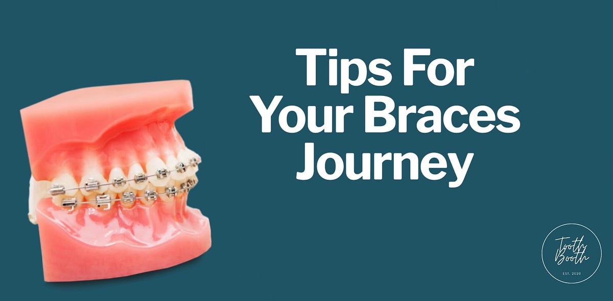 Tips For Your Braces Journey TTB by Team Tooth Booth Medium
