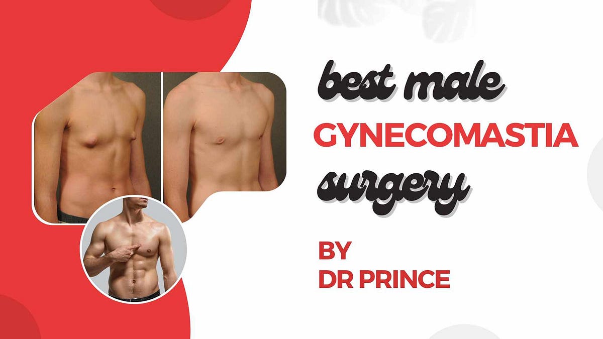 Understanding Surgery A Comprehensive Overview by dr.prince Mar, 2024 Medium