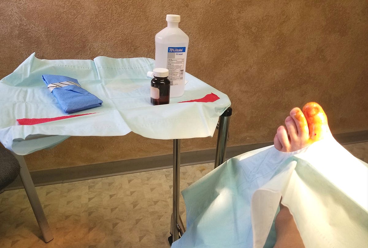 Recovering from Foot Surgery A Guide to PostOperative Care with Gold Coast and Brisbane