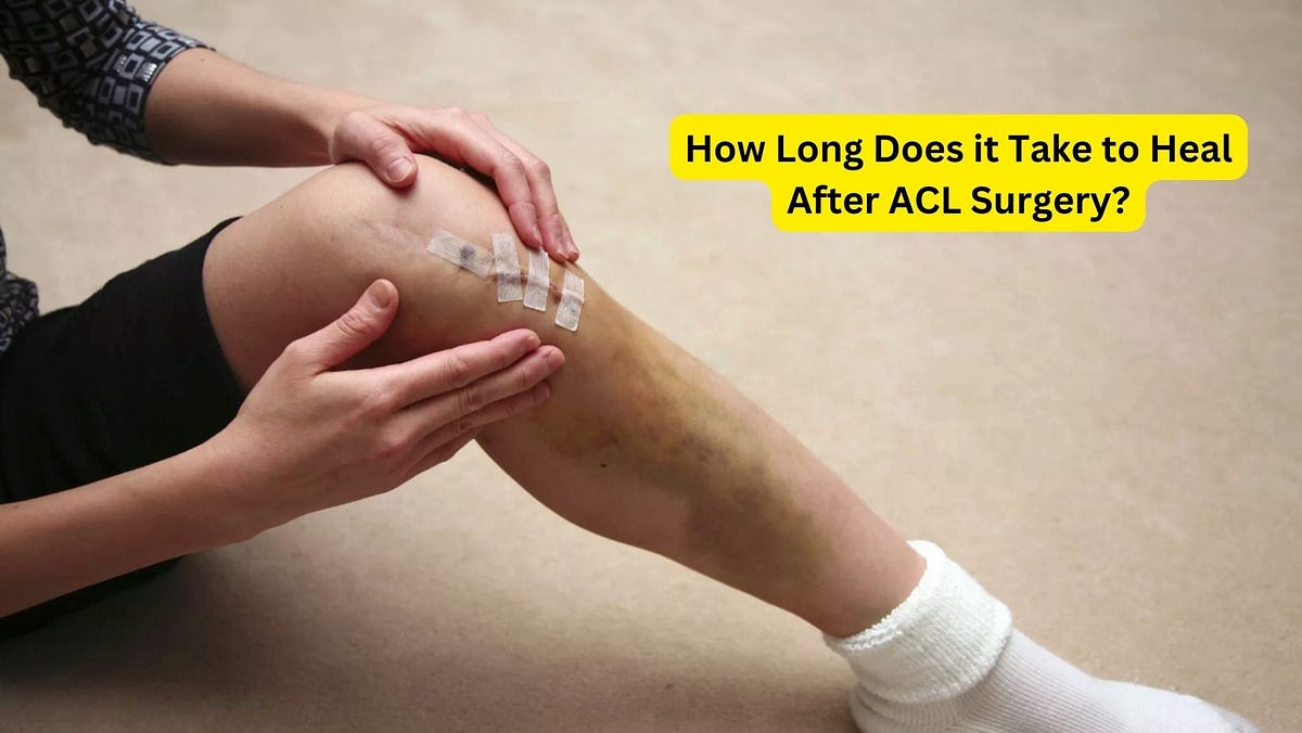 How Long Does it Take to Heal After ACL Surgery? by Indianarthroscopy