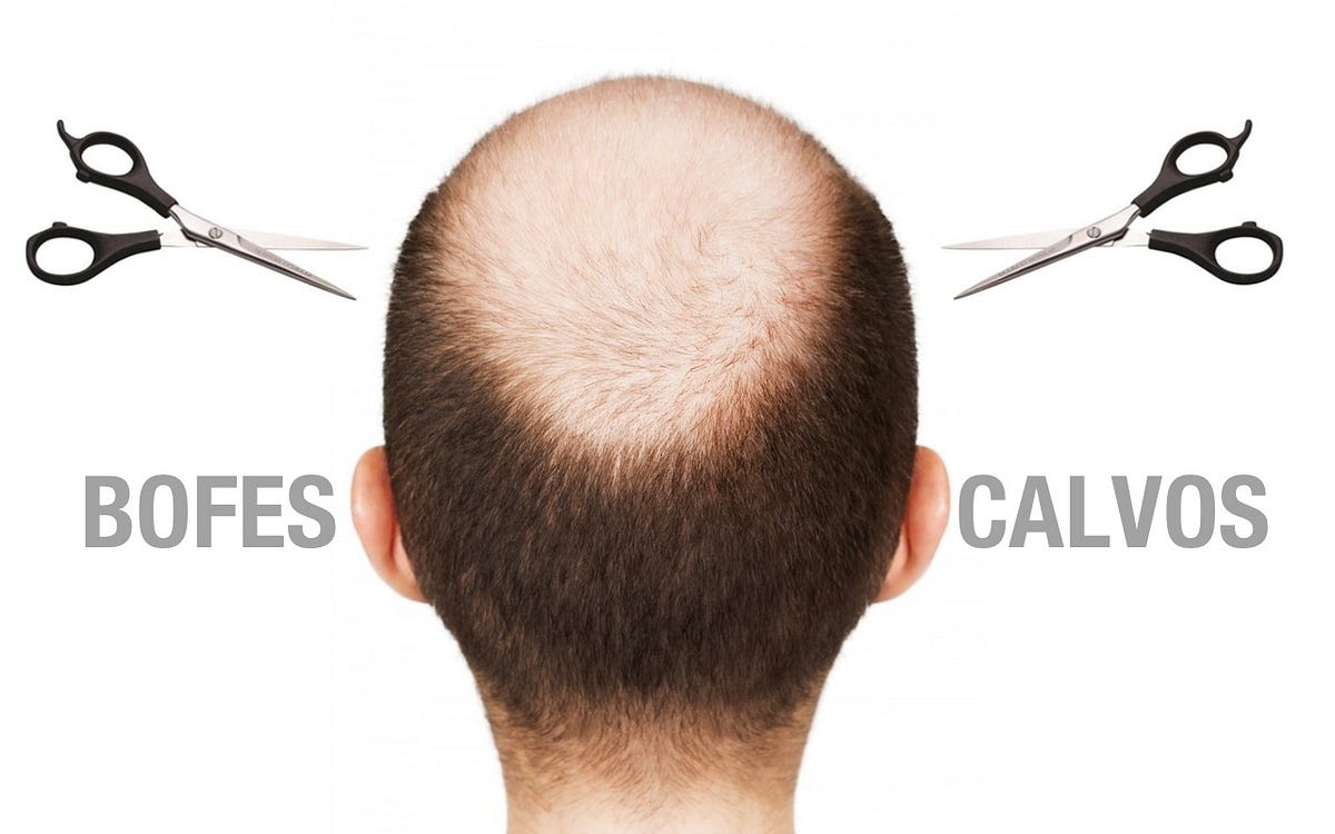 Corte de cabelo ideal para o homem calvo! 👴 | by Paola Gavazzi | TRUQUES  DE MAQUIAGEM - Paola Gavazzi
