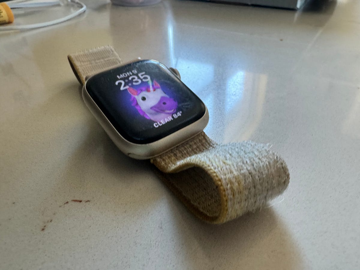 Picture of Apple Watch Family Setup — A long-term review | by Trey | Medium