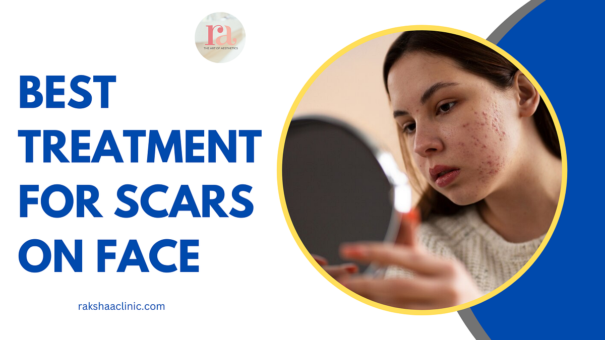 Best Treatment For Scars on Face. Scars on the face can act as