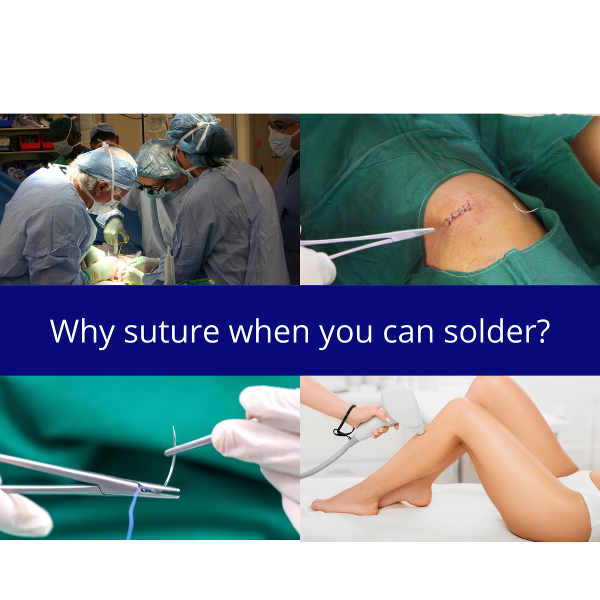 Why suture when you can solder?. Soon sutures and stitches for surgery