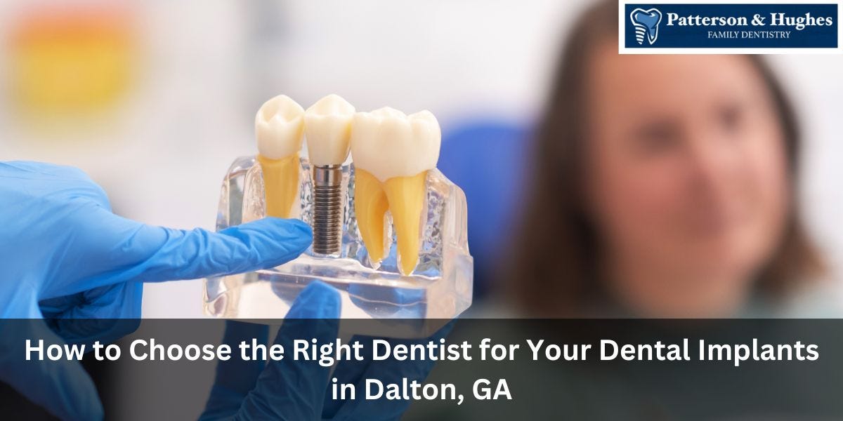 How to Choose the Right Dentist for Your Dental Implants in Dalton, GA