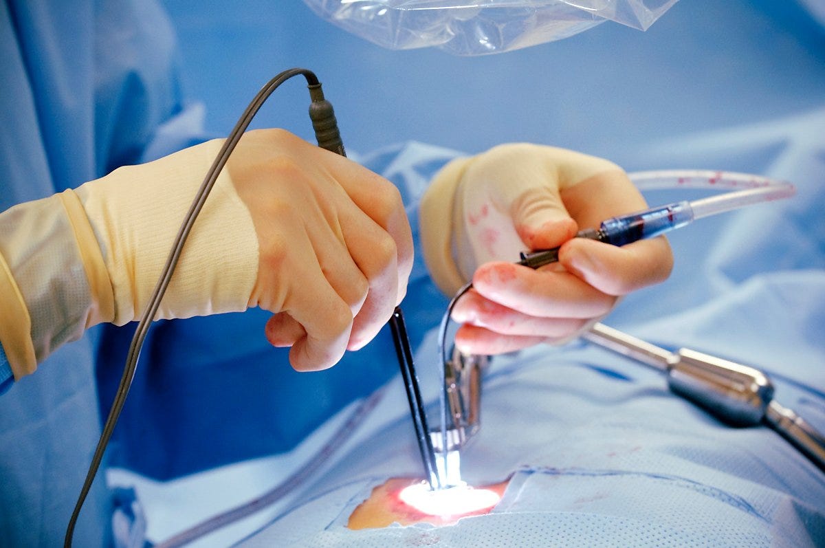 Piles Laser Operation Cost in Mumbai Everything You Need to Know by