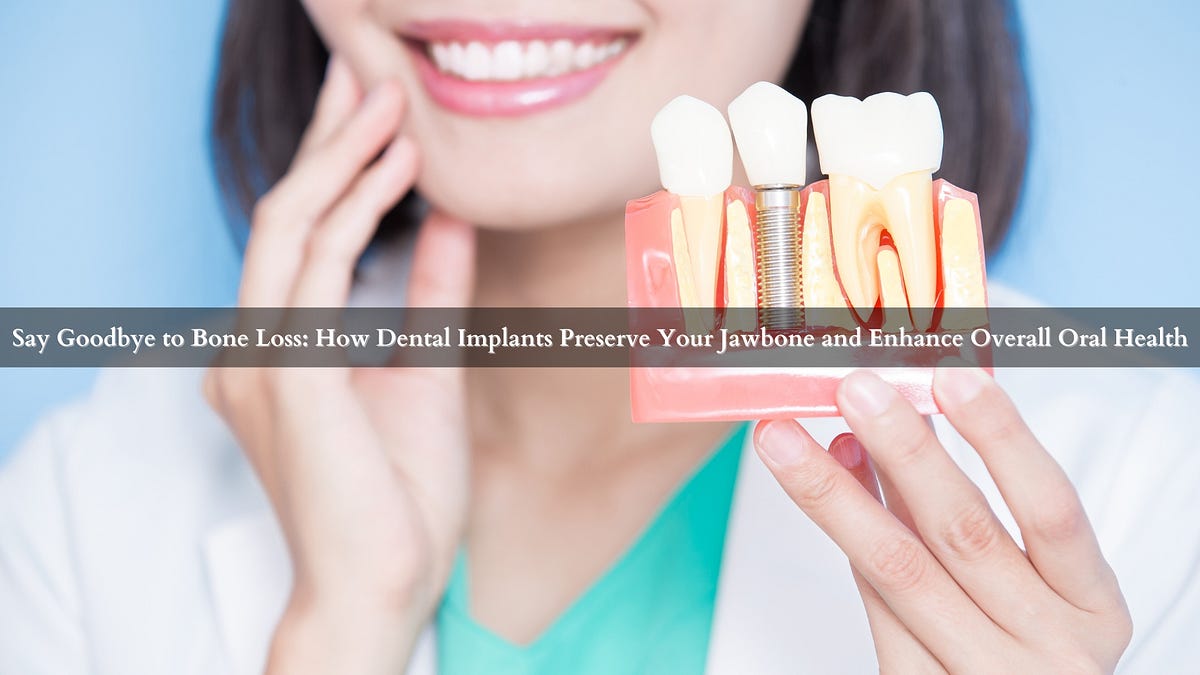Say Goodbye to Bone Loss How Dental Implants Preserve Your Jawbone and Enhance Overall Oral