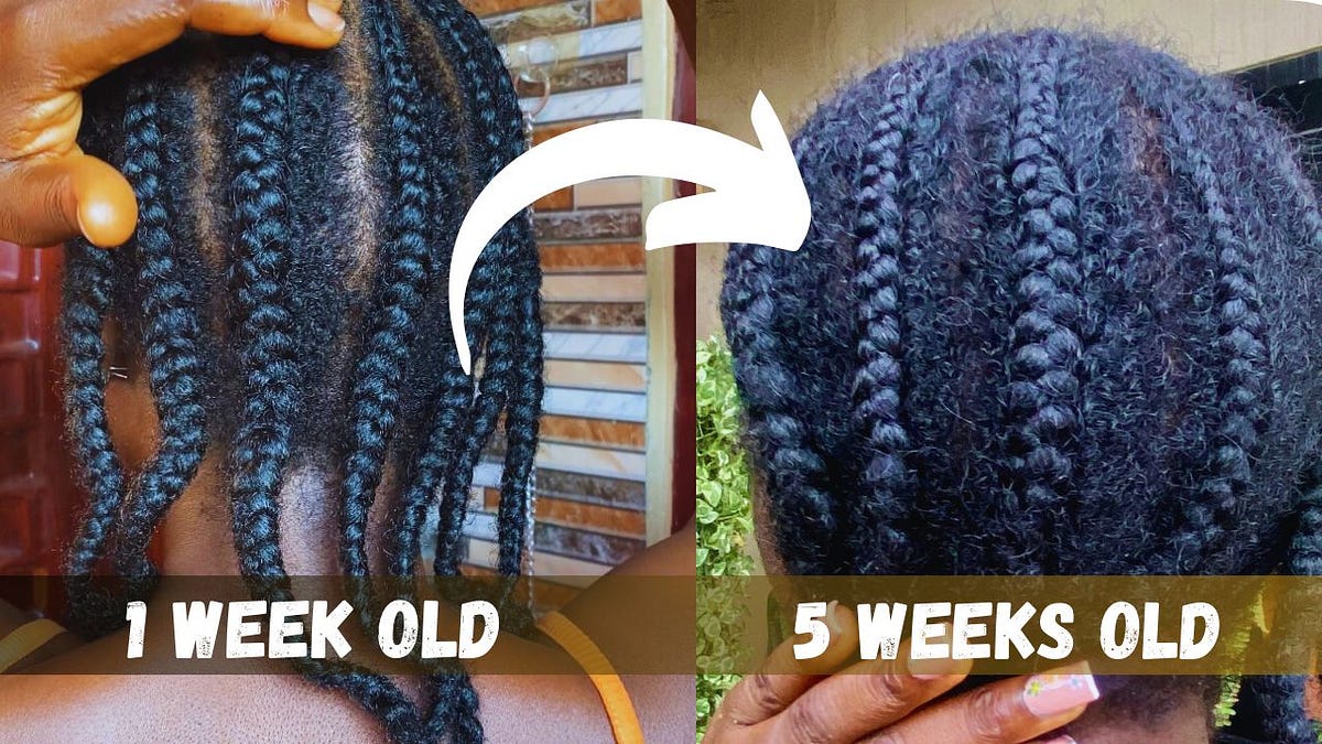 The Easiest Way to Take Down 4C Hair Braids or Cornrows A StepbyStep