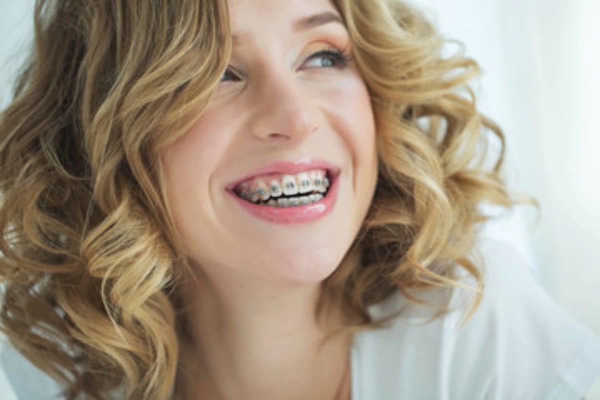 Common Dental Problems & How To Prevent Them With Braces by Khan