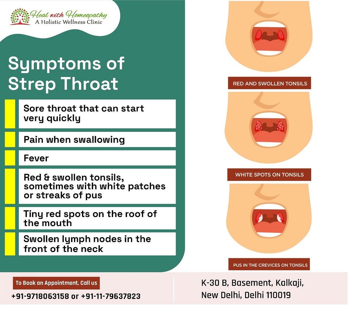 Symptoms of Strep Throat - Dr. Geeta Rani Arora - Medium