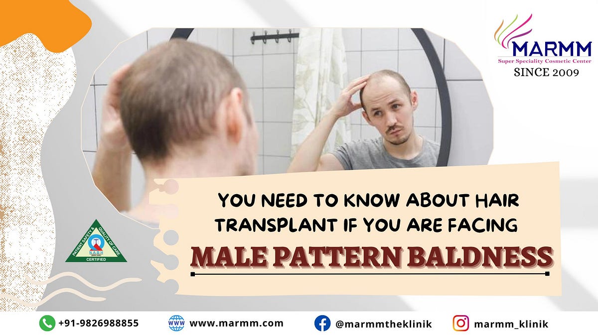 You Need To Know About Hair Transplant If You Are Facing Male Pattern Baldness By Marmmklinik 0393