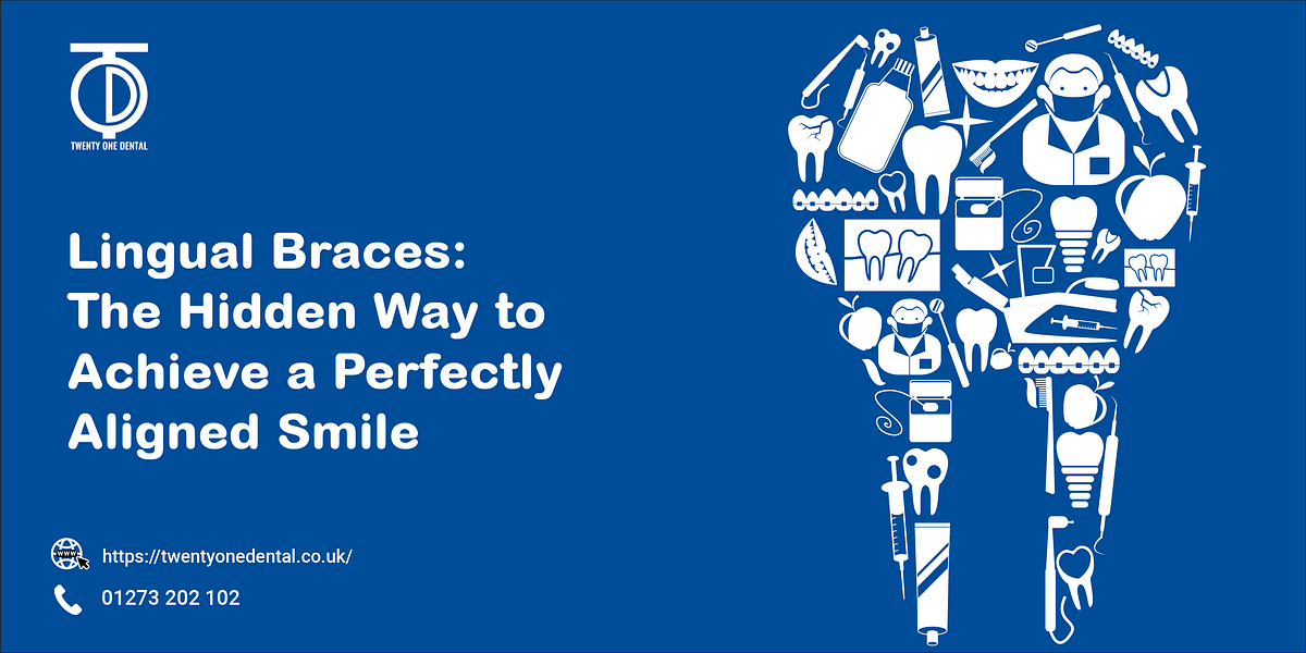Lingual BracesLingual Braces The Hidden Way to Achieve a Perfectly