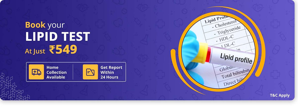 Lipid Profile Test in Delhi | Lipid Profile Test Price Delhi - cncpath ...