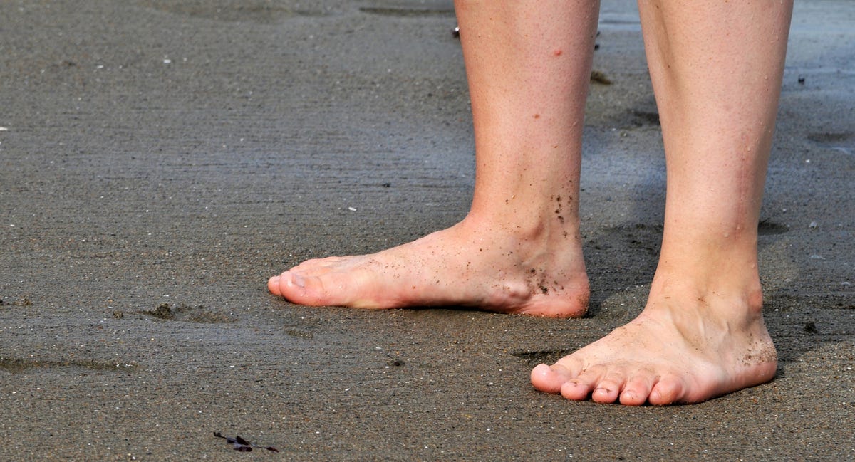 Understanding Flat Feet Causes, Symptoms, and Treatment Options by