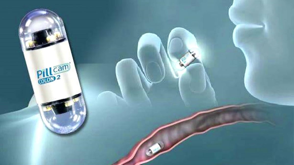 What is Exactly Wireless Capsule Endoscopy? by Dr Essam Medium