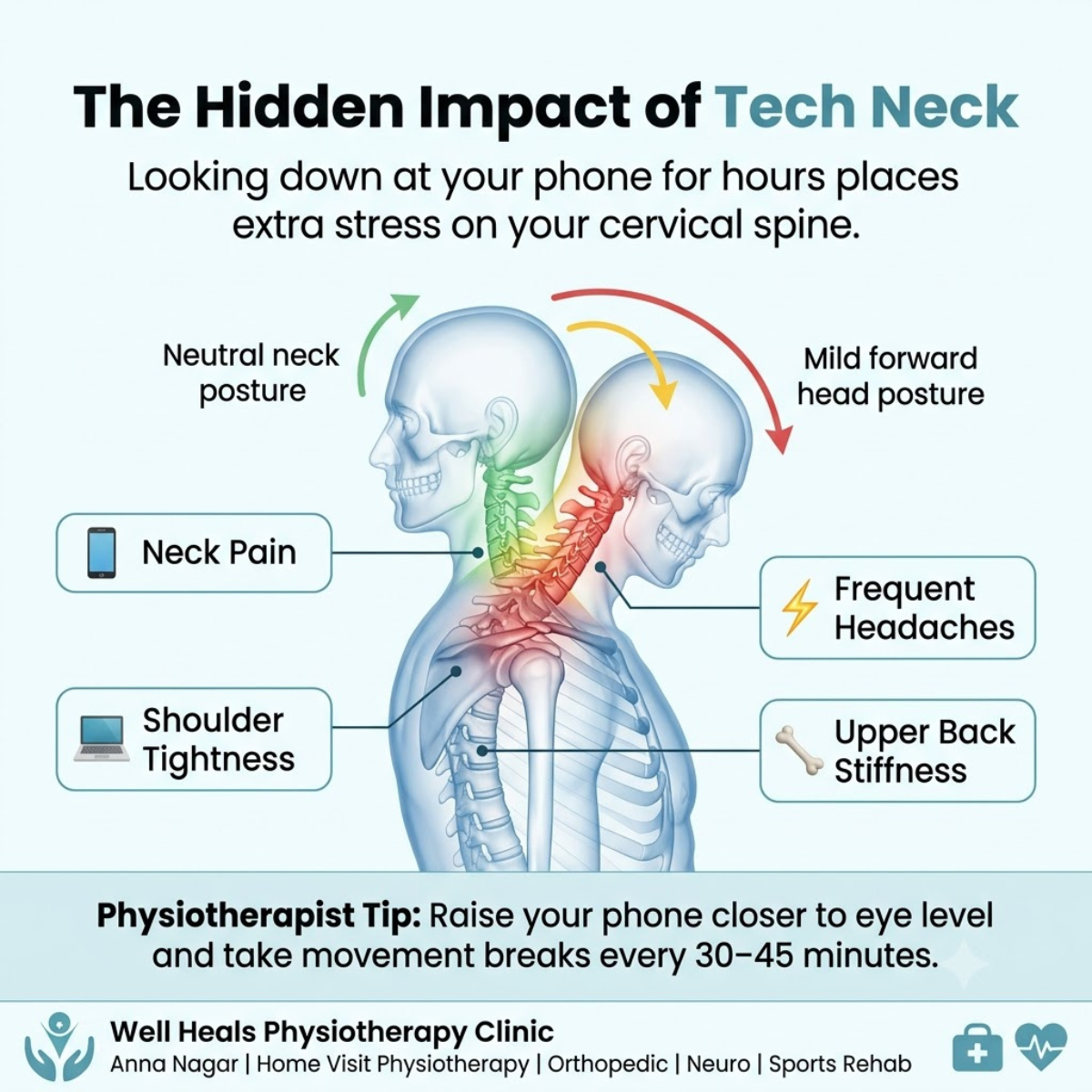 Is Your Mobile Phone Causing Your Neck Pain? The Hidden Health Problem Millions Ignore