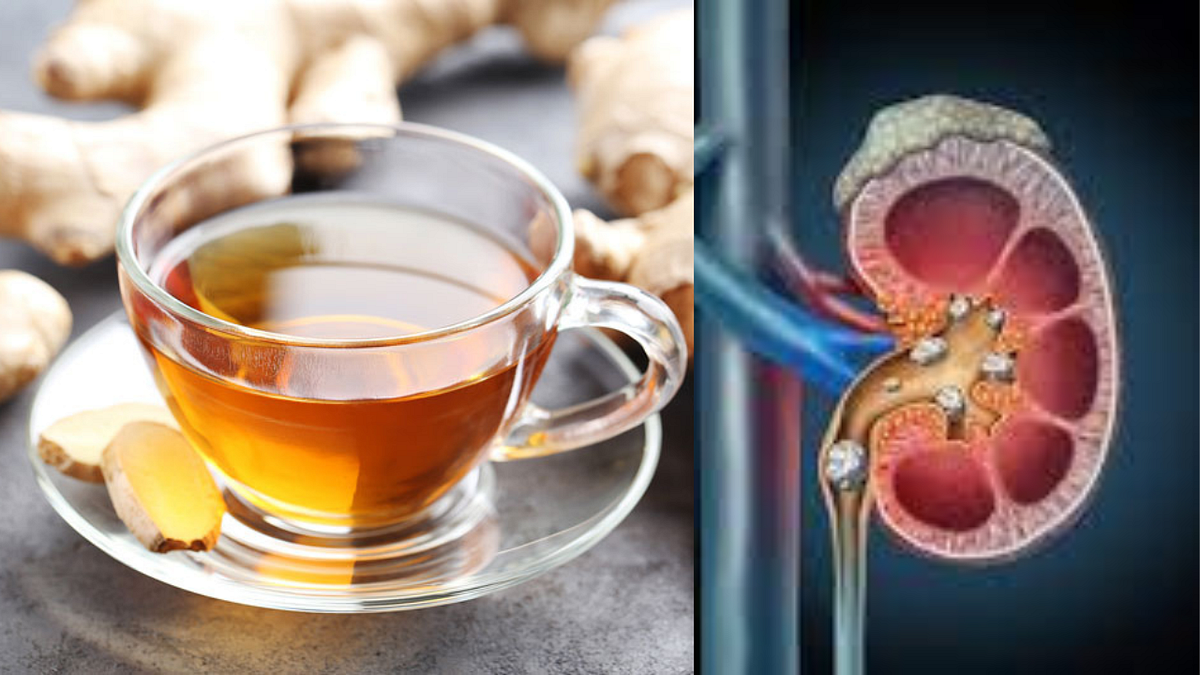 Ginger Tea Magic “Say Goodbye to Kidney Stones”